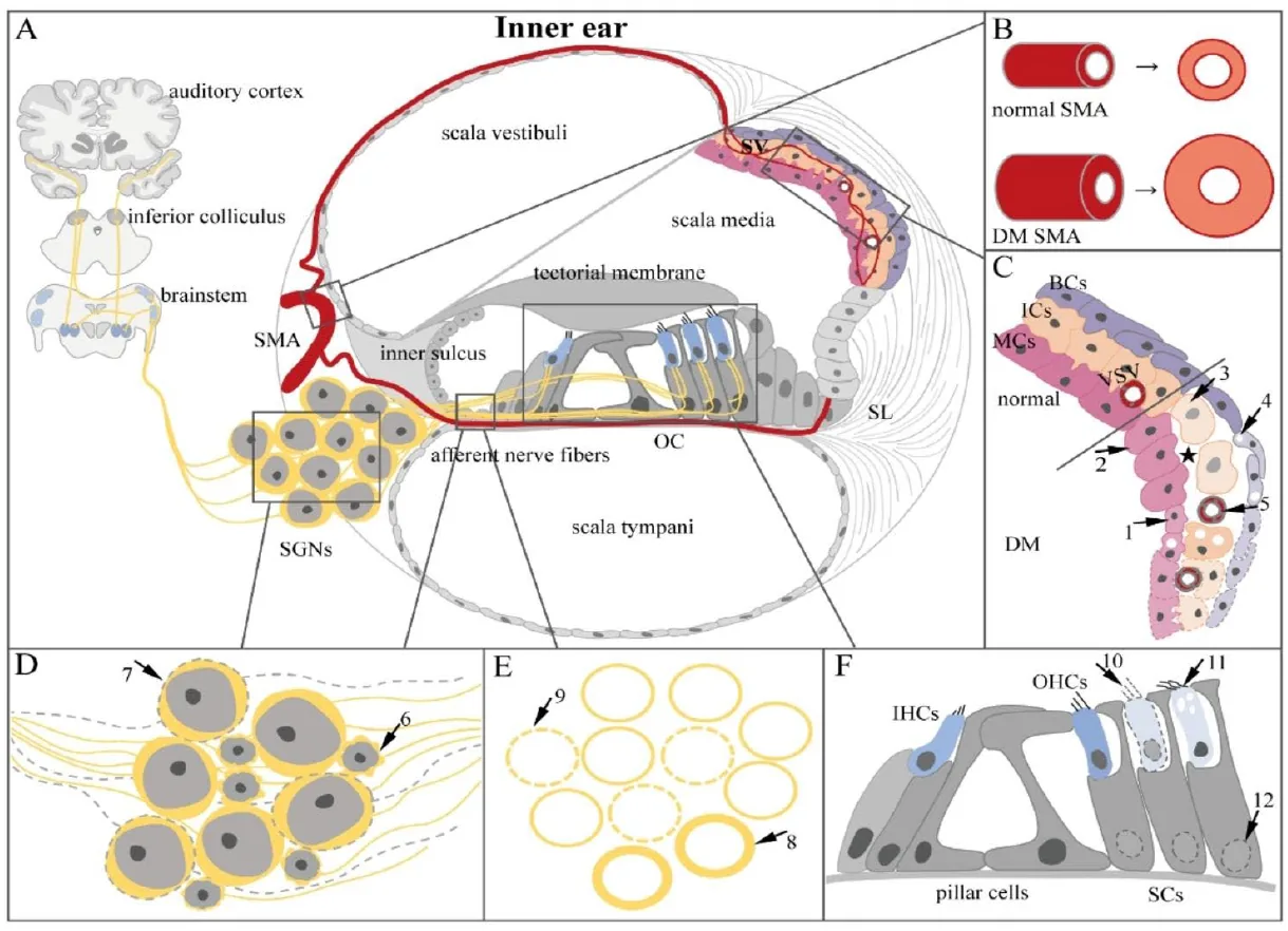 The effect of diabetes on the inner ear