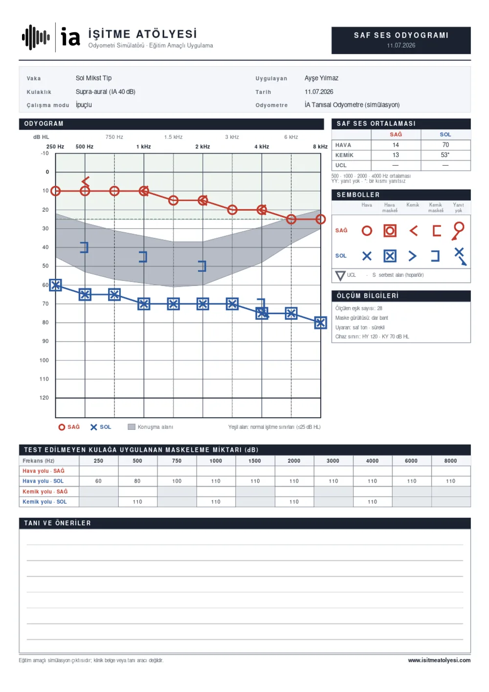 Sample A4 audiogram report produced by the simulator
