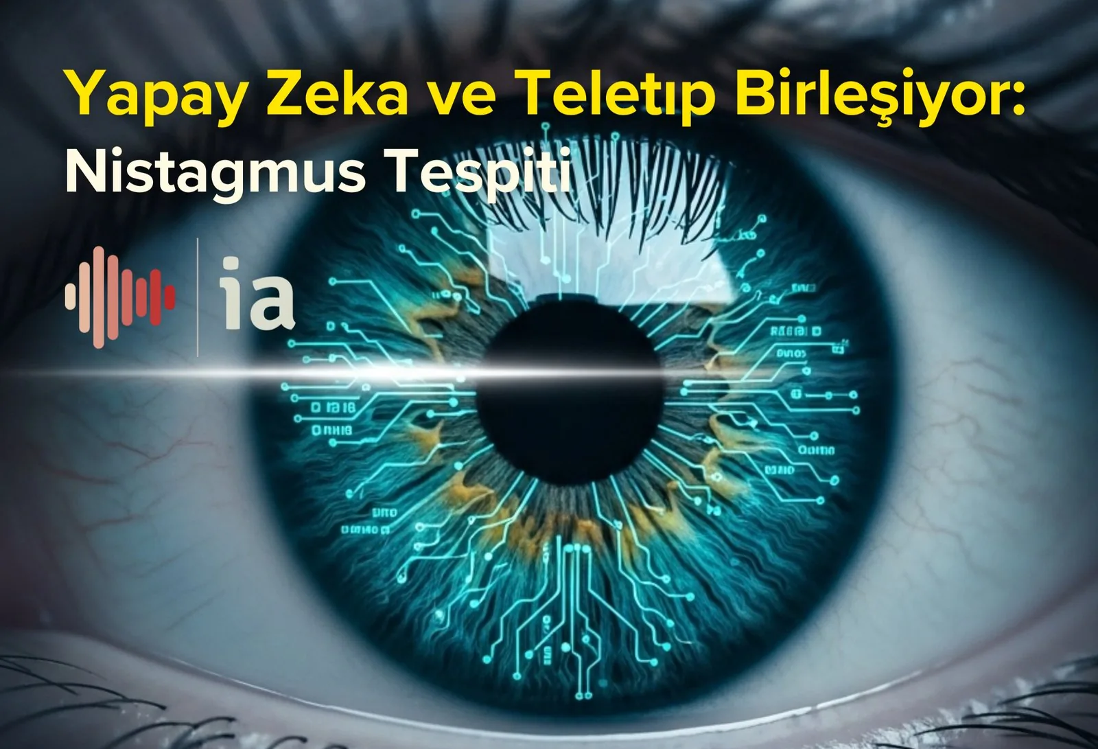 Nystagmus Detection with an AI-Supported Telemedicine System